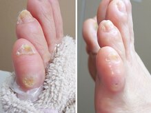 リゼラアンドコー 船橋店/ドイツ式フットケア専門店