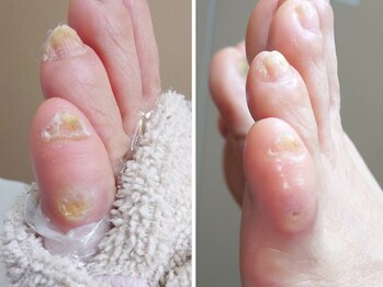 リゼラアンドコー 船橋店/ドイツ式フットケア専門店