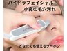 新メニュー☆【黒ずみ/開き撃退】小鼻毛穴洗浄ハイドラ＋美容液¥4000→¥2500
