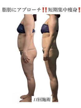 痩身革命 大宮店/ダイエットリンパマッサージ