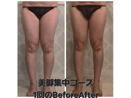 シャングリラ(Shangri-la)の写真