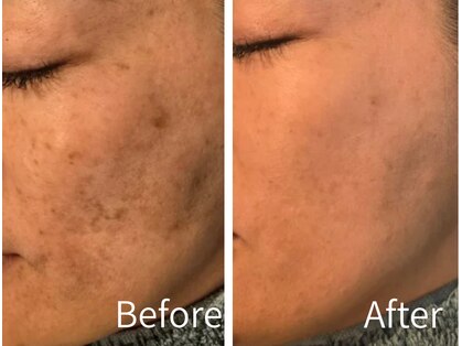 ミント(Mint)の写真