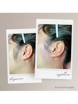 ブラジリアンワキシング シックスナイン(BrazilianWaxing69)/女性 / もみあげ