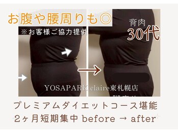 ヨサパーク クレール 東札幌店(yosa park claire)/プレミアムダイエットコース成果
