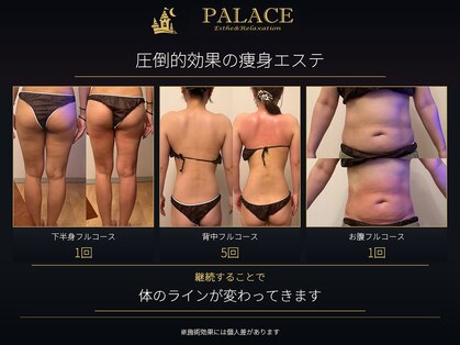 パレス(PALACE)の写真