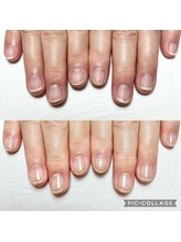 シャルム 本厚木(charme)/自爪育成ジェルコース