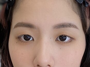 ビューティーガーデン イース/AFTER