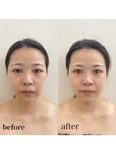 リニューサロン 本院(renew salon)/カッサマッサージ