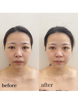 リニューサロン 本院(renew salon)/カッサマッサージ