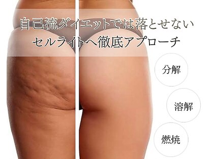 メイリー(MEILLI)の写真