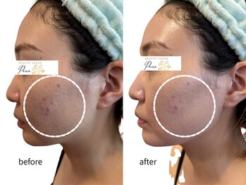 ポノ(Pono)/毎日鏡を見たくなるお肌へ♪