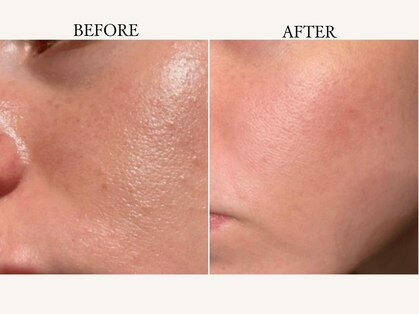 ティアラ(TIARA)の写真