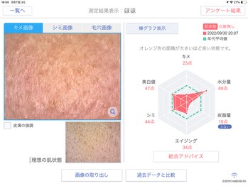 Rr.FACIAL郡山店　毛穴×たるみ×小顔専門店/