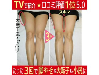 やまもと整骨院/【３回で】この改善レベルが最多