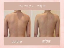 ラボーテアッシュ(La beaute H)の雰囲気（一回でも劇的変化を♪大人気マイクロウェーブ背中コース☆）