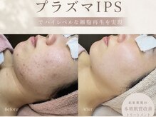 アデュラリアン(Adularian)の雰囲気(肌質改善が得意なサロン◎本気で変わりたいあなたを応援します!)