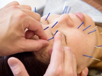かわ鍼灸整体サロン/肌荒れ≪美容鍼≫