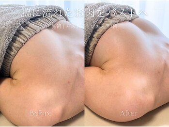 エメ(Aimee)/バストアップエステ