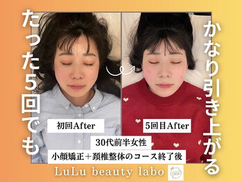 ルルラボ(LuLu beauty labo)/5回でここまで上がる