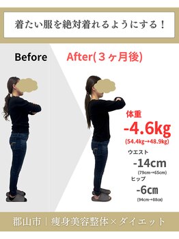 整体院 モンテ(monte)/before＆after