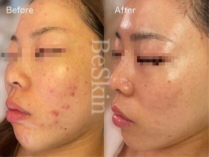 ビースキン 藤沢店(BeSkin)の写真