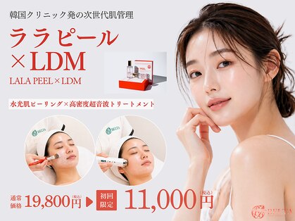 ベルタ(BELTA)の写真