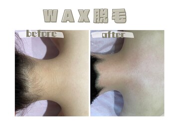 レヴィート(Revept)/【ワックス脱毛】