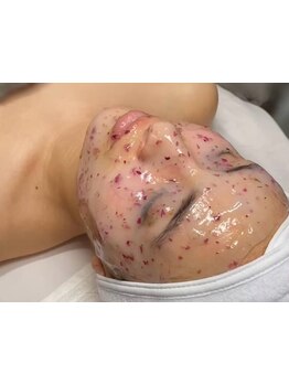 顔脱毛がしたい