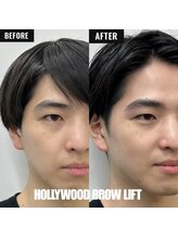 アイアンドコー(EYE&Co.)/眉毛を変えただけで、好印象に