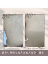モアトゥインクル 福山宮通り店(MORE twinkle)/全身脱毛もお任せ下さい！