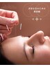 【初回限定】美容鍼♪お顔のシワ・たるみが気になる方におすすめ★30分