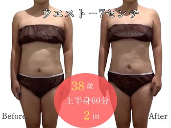 アルピナ(ALPINA)/ウルトランスフォーマー