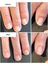 ハンドネイルケア