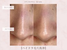 ビベル 八木店(Bebelle)/１回