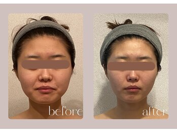 ステラ(STELLA)の写真/【結果重視/小顔×肌質改善】ただ流すだけではなく骨格・筋肉・リンパにアプローチする小顔メソッド/松阪市