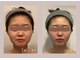 ステラ(STELLA)の写真/【結果重視/小顔×肌質改善】ただ流すだけではなく骨格・筋肉・リンパにアプローチする小顔メソッド/松阪市