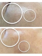 トゥモロー(TOMORROW)/水分量アップしお肌ふっくらへ