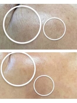 トゥモロー(TOMORROW)/水分量アップしお肌ふっくらへ