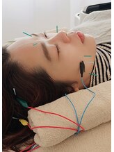 ハリエンジュ(Harienju)/頭皮鍼