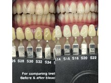 トウキョウスワーズ 池袋店(TOKYO SWRS)/#ホワイトニング #池袋 #渋谷
