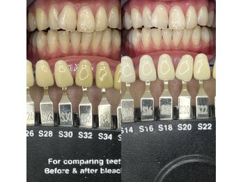 トウキョウスワーズ 池袋店(TOKYO SWRS)/#ホワイトニング #池袋 #渋谷