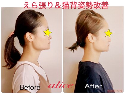 アリス(alice)の写真