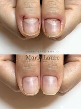 マリーロール 淀屋橋本店(Marie Laure)/自爪育成/深爪矯正/ネイルケア