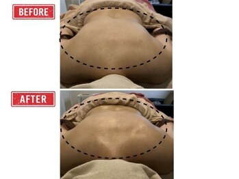 巡りラボ/ビフォーアフター8