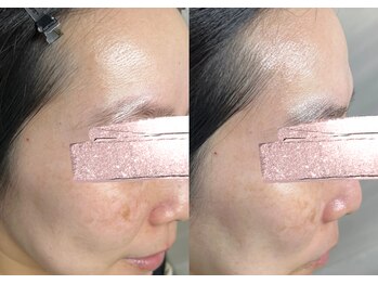 モガナ(mogana)/40代・サブスクプランでご来店