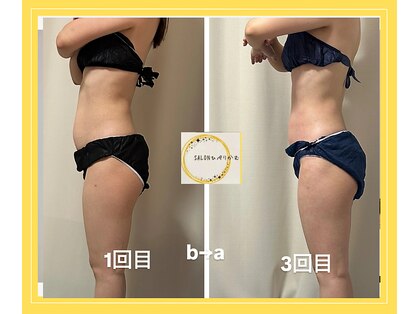 ひぺりかむの写真