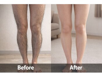 ヨハク(YOHAKU)/20代前半 &nbsp;男性 &nbsp;10回施術