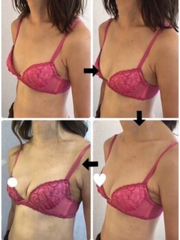 エステティックサロン ピュール ボーテ 東金店/バストアップ症例！