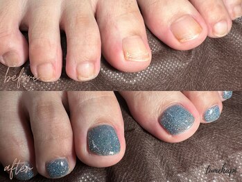 悩んでた爪まわりスッキリきれい