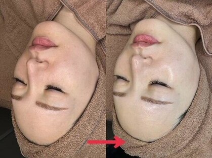 ナチュラックスビューティー 恵比寿店(NaturaxBeauty)の写真